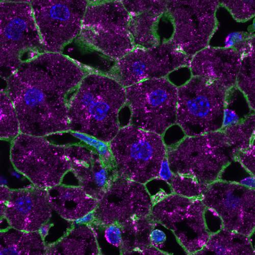 Lilylivered liver cells MPICBG