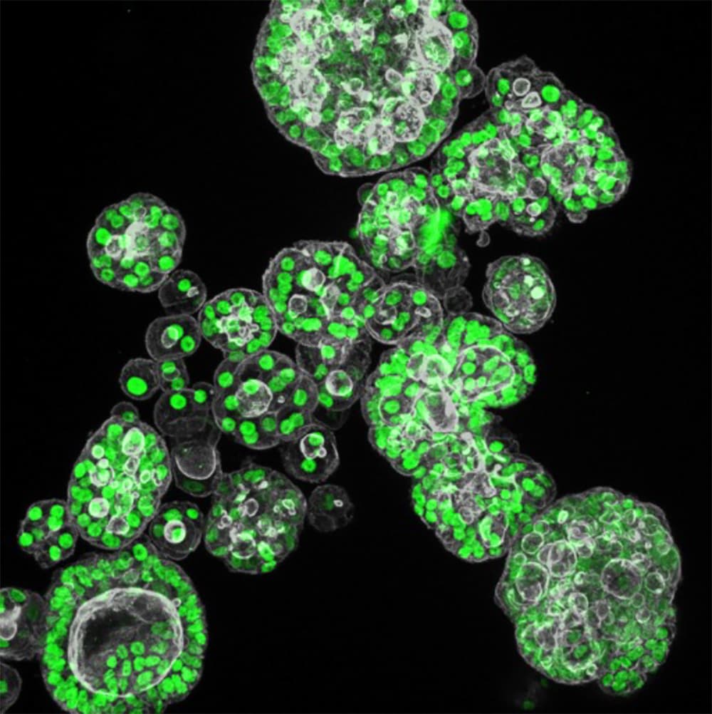 Pbs Cell Mini Mini organs in space: MPI-CBG