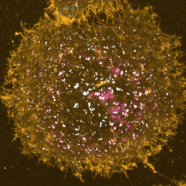 microscopy image of the membrane of a human melanoma cell
