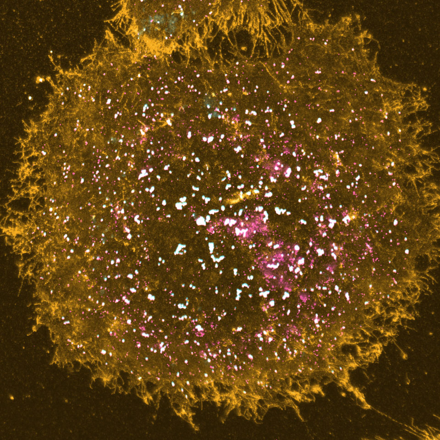 microscopy image of the membrane of a human melanoma cell