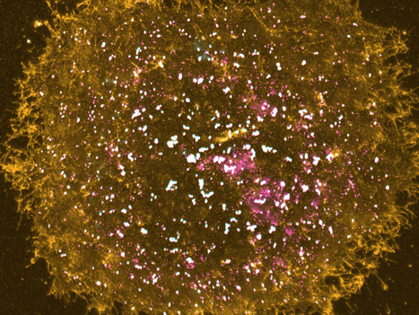 microscopy image of the membrane of a human melanoma cell