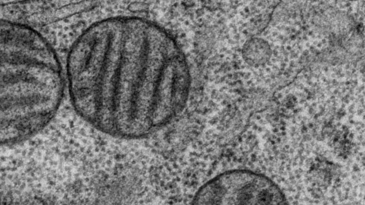 Electron Microscopy MPICBG